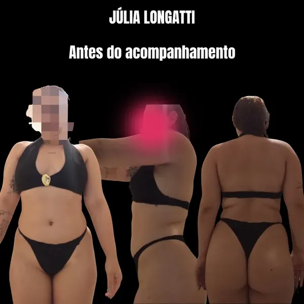Júlia Longatti — Antes do acompanhamento