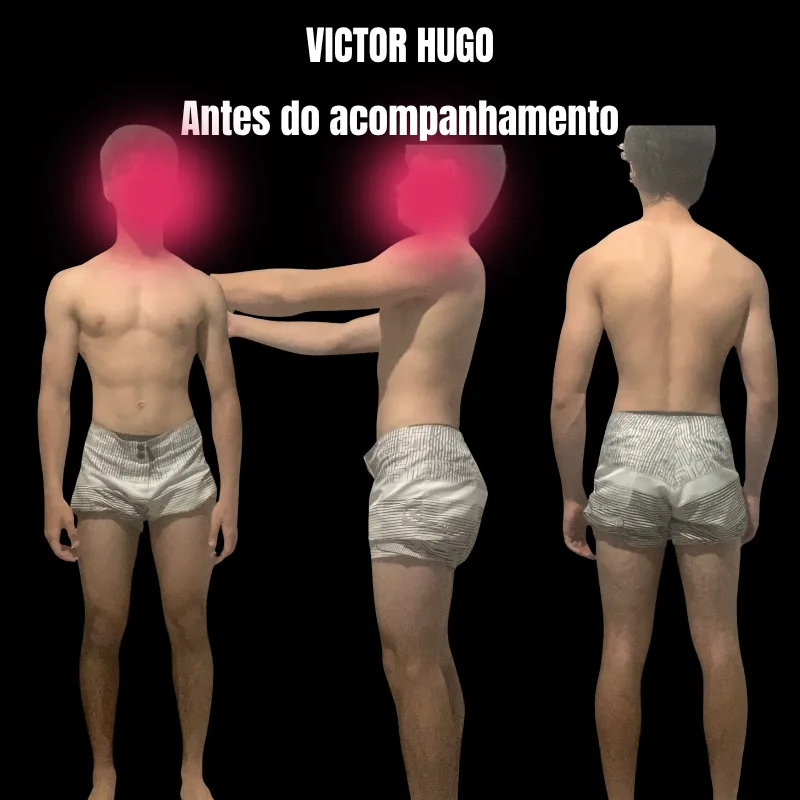 Victor Hugo — Antes do acompanhamento